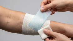Wound care